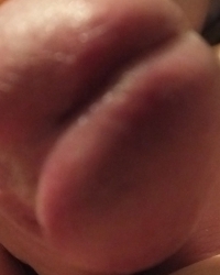 photo-thumb
