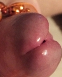 photo-thumb