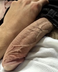 photo-thumb
