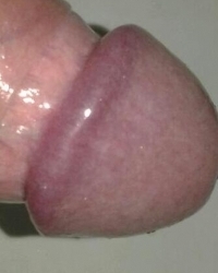 photo-thumb