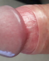 photo-thumb