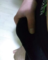 photo-thumb