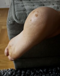photo-thumb