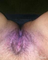 photo-thumb