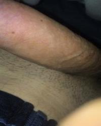 photo-thumb