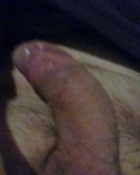 photo-thumb