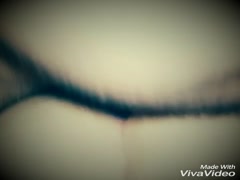 Thumb 13