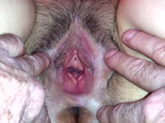Thumb 18