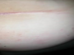 Thumb 20