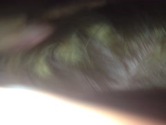 Thumb 20