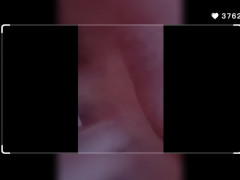 Thumb 8