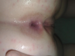Thumb 8