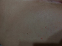 Thumb 7