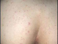 Thumb 8