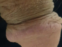 Thumb 10